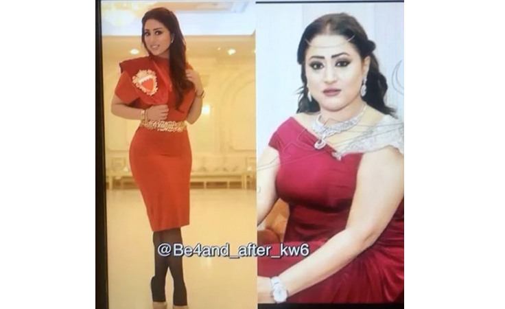 صورة شيماء سبت قبل عمليات التجميل تشعل مواقع التواصل الاجتماعي.. وهذا كان ردّها..بالفيديو!